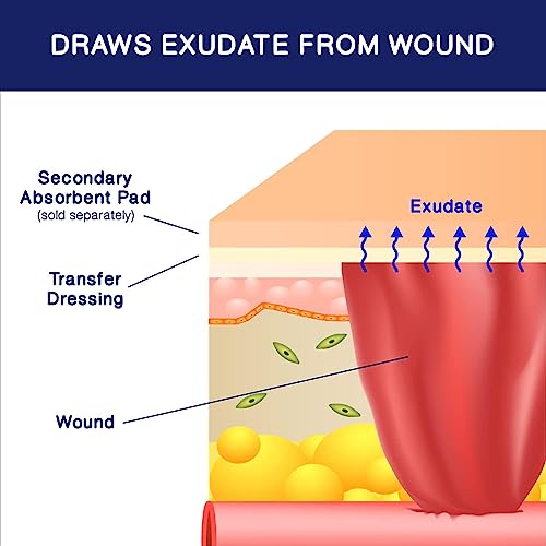 MedVance Soft Silicone Exudate Transfer Dressing, 6"x8", Box of 5 | Sterile And Individually Wrapped - Transfer Silicone Bandages - Breathable - Highly Absorbent - size: 6 X 8 Inch (Pack Of 5)