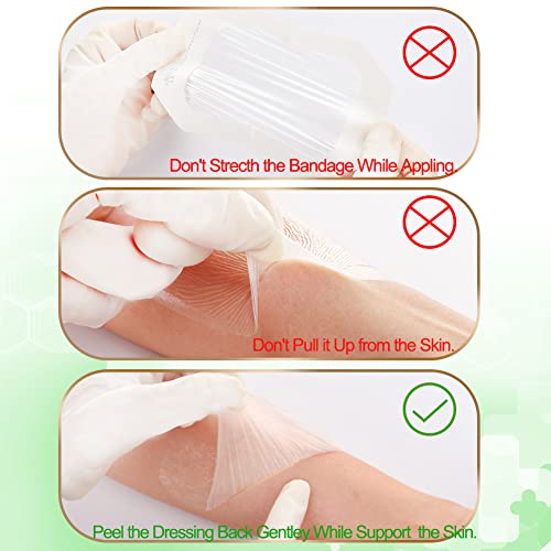 NeuHeils Waterproof Transparent Film Dressing, 2 3/8" x2 3/4", 100 Pack - size: 2 3/8" x 2 3/4"