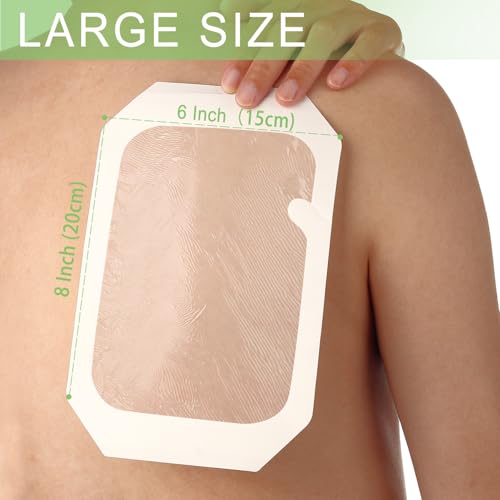 NeuHeils Extra Large Transparent Film Dressing 6"x8", 20 Pack - size: 6''x8''
