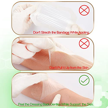 NeuHeils Transparent Film Dressing 2 3/8'' x 2 3/4'', 200 Pack, Waterproof Wound Cover Bandage, Clear IV Catheter Tape, Adhesive Patch, Shower Shield - size: 2 3/8'' x 2 3/4'' (Pack of 2)