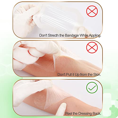 NeuHeils Extra Large Transparent Film Dressing 6"x8", 20 Pack - size: 6''x8''
