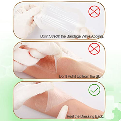 NeuHeils Extra Large Transparent Film Dressing 6"x8", 20 Pack - size: 6''x8''