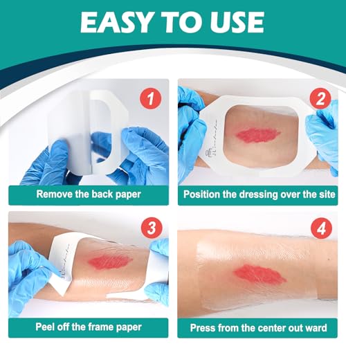 Transparent Film Dressing 4" x 4.75" Box of 30 - Waterproof Bandages for Swimming, Showering, Wounds, Post Surgical Shower or IV Shield, Tattoo Aftercare Bandage, Scar Therapy, Adhesive Patches - size: 4" x 4.75"(30 PCS)